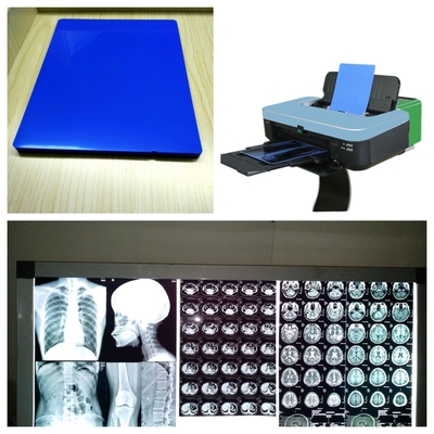 잉크젯 X 레이 필름 시트 8x10 10x12 11x14 14x17 A4 A3 A3+ 13X17 인쇄 속도 1-3분