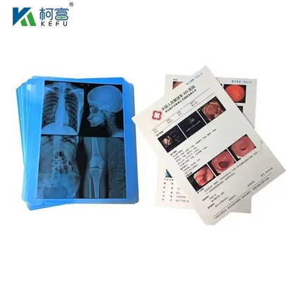 CT 스캐너 건조 엑스레이 24x30 인치 필름 잉크젯 녹색 블루 베이스 의료 엑스레이 필름