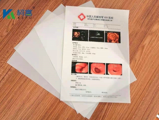 CE ISO9001 A4 세미 투명한 레이저 X- 선 영화 125 마이크론