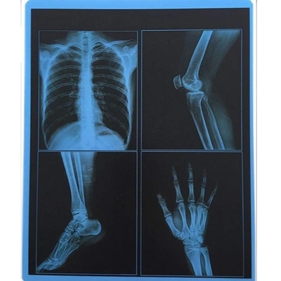35x43CM 블루 의료 엑스레이 필름 CT MRI 이미지 방법