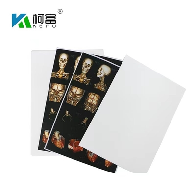 ISO9001 하얀 잉크젯 X- 선 영화 A4 의학 건조박막잔류 OEM