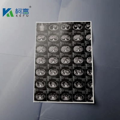180 um A3 하얀 잉크젯 의학 X- 선 영화 규범 엡손 잉크젯 프린터 영화