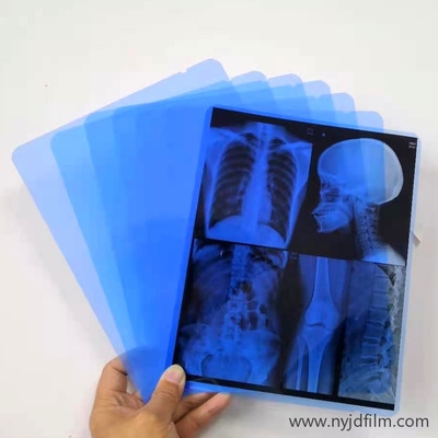 병원 radiology부를 위한 13x17 인치 방수 레이저 청색 X- 선 영화