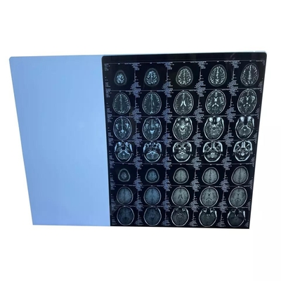 반대 정전기 의학 건조박막잔류 후지 레이저 이미지막 25cmx35cm