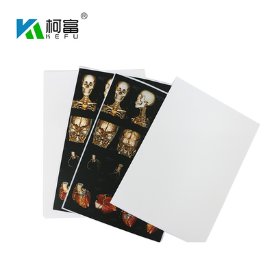후지 프린터를 위한 푸른 백색 베이스 의학 X- 선 영화 35x43CM 10x12 인치 X- 선 건조박막잔류