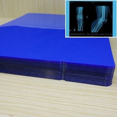 210 마이크론 13X17 인치 의학 잉크젯 영화 고-대비 애완 X- 선 영화