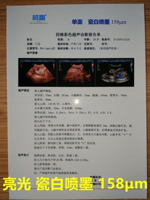 125 마이크론 백색 베이스 불투명한 잉크젯 의료용 필름 삼차원성 ＣＴ 스캔 영화