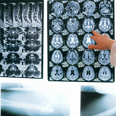 잉크젯 블루 의료 건조 필름 투명 블루 엑스레이 필름 CT DR MRI 방사선 장치