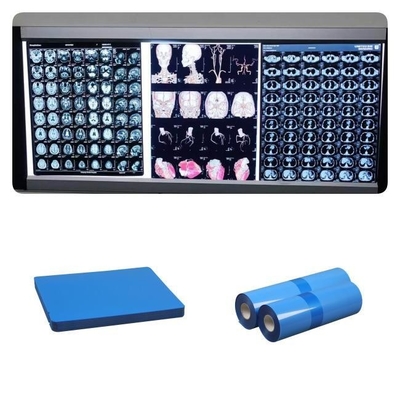 DR CT MRI 의학 잉크젯 X- 선 영화 210 마이크론 청색 베이스 잉크 8x10 A4 A3 10 인치 롤