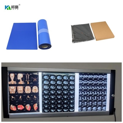 푸른 기지 마른 잉크젯 의학 X- 선 영화 DR CT MRI 염료 잉크 8x10 A4 A3 100장 시트