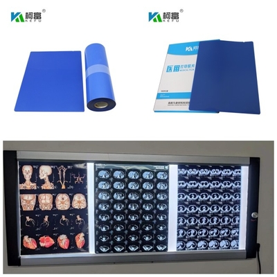 의학 푸른 기지 잉크젯 X- 선 영화 DR CT MRI 염료 잉크 14는 Ｘ 125 시트 롤 10x12로 조금씩 움직입니다