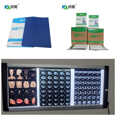 DR CT MRI 의학 잉크젯 건식 X- 선 영화 280gsm 염료 잉크 8x10 13x17 A4 A3 시트