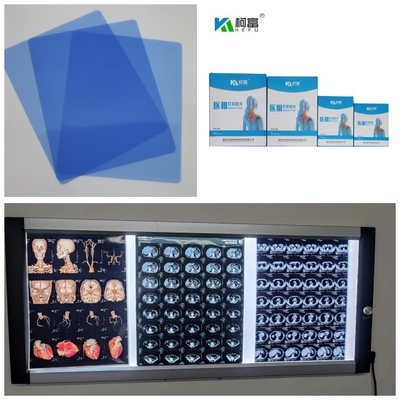 푸른 기지 의학 잉크젯 건조박막잔류 DR CT MRI X- 선 210 마이크론 8x10 A4 A3 14 인치는 회전합니다