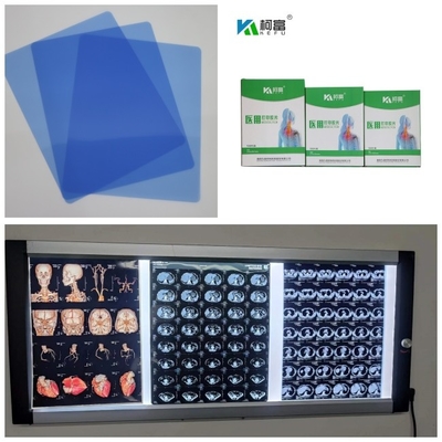 DR CT MRI 의학 잉크젯 X- 선 영화 210 마이크론 청색 베이스 잉크 8x10 A4 A3 10 인치 롤
