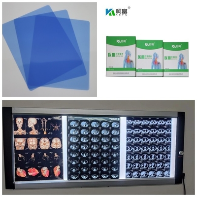 DR CT MRI 이미지 10x12 11x14 A4 A3의 280gsm 의학 X- 선 영화 잉크젯 푸른 기지를 출력하세요