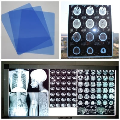종이 8x10과 디지털 DR CT MRI 카세트를 위한 210 um 잉크젯 의학 X- 선 필름 청색