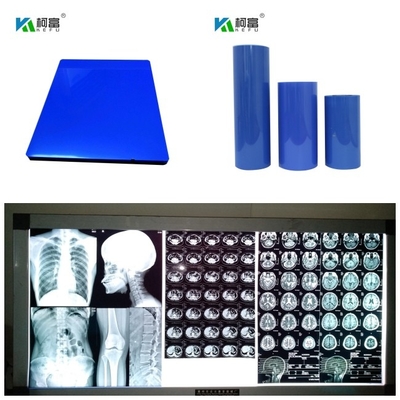 280gsm 의학 마른 잉크젯 X- 선 영화 푸른 기지 디지털 컬러 영상 출력