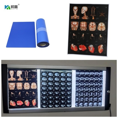 14x17inch 컬러 화상을 위한 디지털 화상 280gsm을 위한 푸른 기지 의학 잉크젯 X- 선 영화