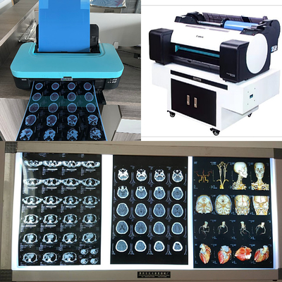 DR CT MRI 의학 잉크젯 X- 선 영화 210 마이크론 청색 베이스 잉크 8x10 A4 A3 10 인치 롤