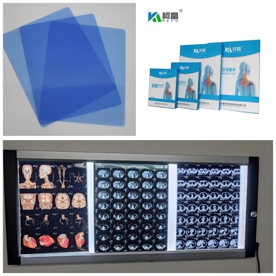 CT DR MRI 잉크젯 의학 X- 선 영화 3D 영상 출력 8x10 11x14  14X17 인치