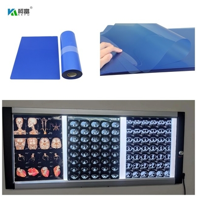 CT DR MRI와  3D CT MRI 영상 출력 14x17을 위한 210 마이크론 잉크젯 의학 X- 선 영화