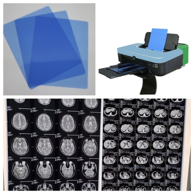 210 미크론 블루 잉크젯 X선 필름 MRI 이미지 출력