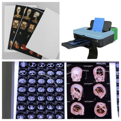 화이트 오파크 잉크젯 X 레이 필름 캐논/에프슨 프린터 125/150 미크론 CT MRI