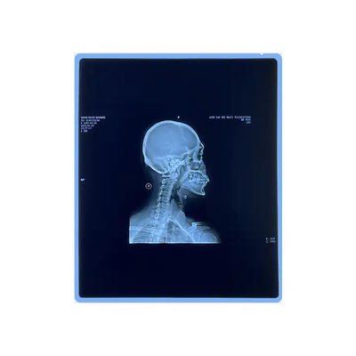 의료용 엑스레이 건조 필름 의료용 엑스레이 잉크젯 필름