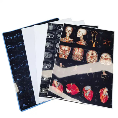 잉크젯 의료 건조 필름 투명 블루 엑스레이 필름 CT DR MRI 방사선 장치