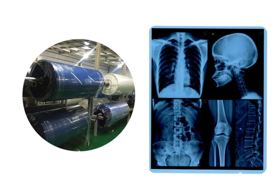 의료용 엑스레이 필름 롤 잉크젯 블루 베이스 CR DR CT MRI 이미지 출력