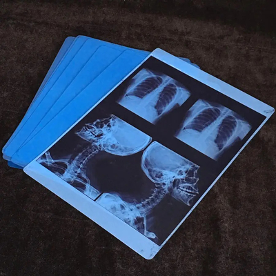 8x10 인치 100 장 / 패키지 10 팩 / 박스 잉크젯 인쇄용 열 필름 크기 패키지
