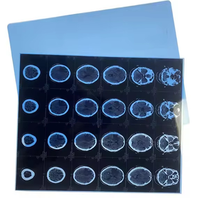 의료용 엑스레이 필름 롤 잉크젯 블루 베이스 CR DR CT MRI 이미지 출력