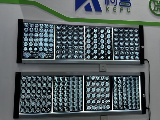 자동 의료 필름 X선 밀도 조절 레이저 이미징 결정 맑은 결과