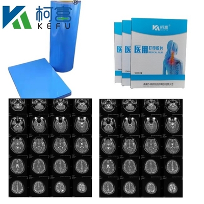 의료 영상 CT DR 잉크젯 블루 필름 의료 엑스레이 PET 필름 A4