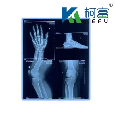 공장 의료 엑스레이 필름 블루 민감 의료 엑스레이 필름