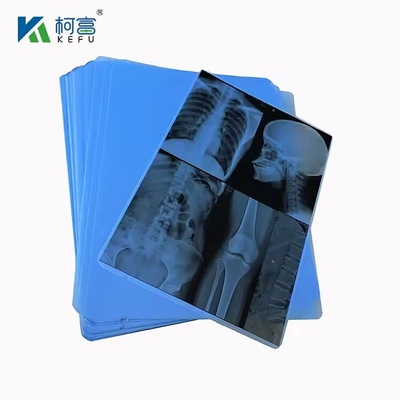 고품질 의료용 엑스레이 필름과 녹색 필름 8*10in\20*25cm
