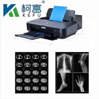 A3 커스텀 사이즈 시트 롤 블루 잉크젯 의료 필름 의료 이미지 인쇄용 X 레이 CT, CR, DR, MTR