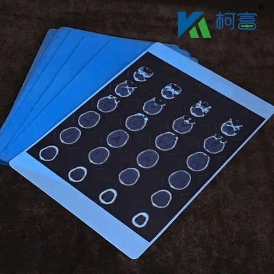 블루 의료 엑스레이 건조 필름 병원 CT 의료 이미지 방수 잉크젯