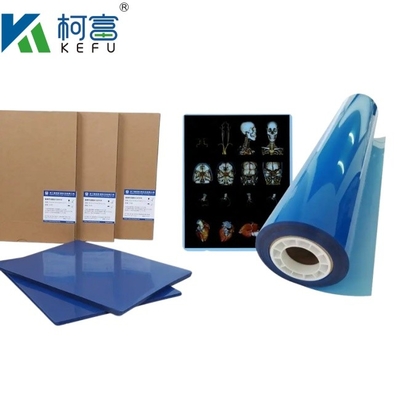 에프슨 A4 PET 건조 푸른 의료 레이저 엑스레이용 맞춤형 크기 35x43 잉크젯 블루 의료 엑스레이 필름
