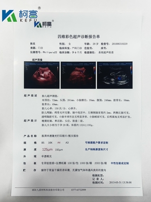 잉크젯 투명 의료 건조 필름 백색 X선 필름 CT DR MRI 방사선 장치