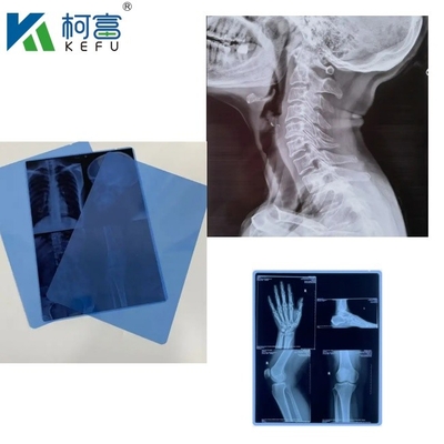 의료용 엑스레이 필름 건조 블루 잉크젯 필름 CT DR 필름 A4 8x10 시트 또는 롤