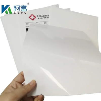 흰색 잉크젯 의료 필름 잉크젯 프린터용 엑스레이 필름 A3/A4 장