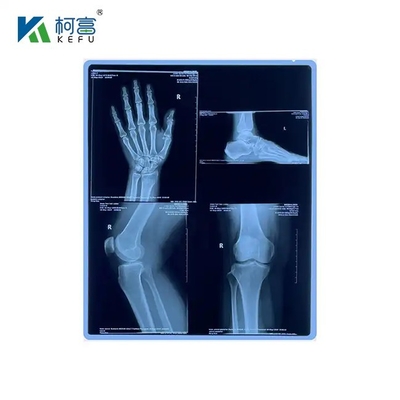 오래 지속되고 유지보수가 적은 의료 레이저 필름 16x21in 0.17mm 최소 유지보수와 함께 장기간 이미지 품질을 유지