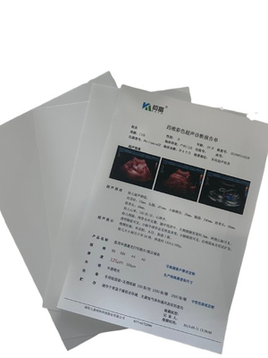 미니 밀도 0.28D 엑스레이 필름 정확하고 상세한 진단 결과를 위해