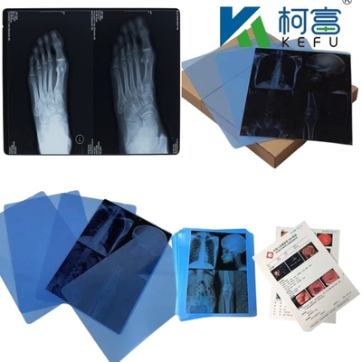 14*17 인치 의료용 X선/CT/DR 건조 스캔 필름