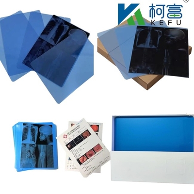 맞춤형 크기 블루 화이트 잉크젯 의료 엑스 레이 필름