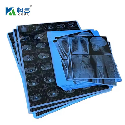 클리닉 및 병원용 블루 PET 기반 X선 열 / 잉크젯 필름 의료 이미지