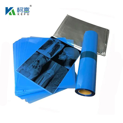 175mic 215mic 고화질 의료 영상 CT DR 잉크젯 블루 필름 의료 엑스레이 애완 동물 필름 A3 A4 투명 블루 프린팅 필름