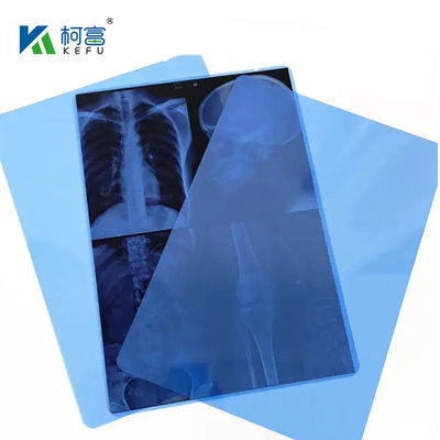 10*12in 의료 엑스레이 / CT / DR 드라이 스캔 필름 엑스레이 레이저 이미지 프린터 및 열 이미지 프린터 장비