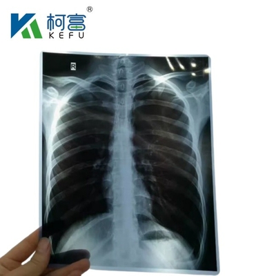 8x10 인치 14x17 인치 블루 의료 엑스레이 필름 대체 후지 의료 건조 필름 클리닉 및 병원